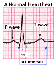 heart beat Normal ECG